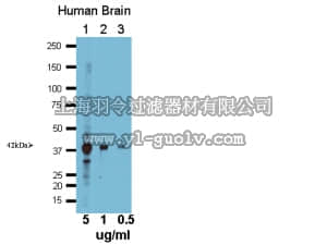 merck millipore,默克密理博,AB15644,Anti-HuD Antibody