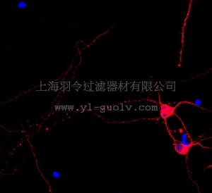 merck millipore,默克密理博,AB15708C3,Anti-Beta III Tubulin, Cy3 Conjugate Antibody