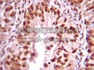 merck millipore,默克密理博,AB1607,Anti-Phosphothreonine Antibody