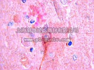 merck millipore,默克密理博,AB1761,Anti-Protein Gene Product 9.5 Antibody