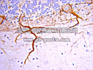 merck millipore,默克密理博,AB1987,Anti-Neurofilament M (145 kDa) Antibody, CT