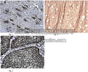 merck millipore,默克密理博,AB2208,Anti-phospho STEP61/46 Antibody, (Ser221/Ser49)