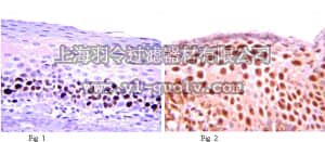 merck millipore,默克密理博,AB2263,Anti-MEF2D Antibody