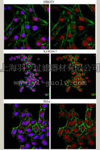 merck millipore,默克密理博,AB2277,Anti-FOXP1 Antibody