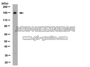 merck millipore,默克密理博,AB2281,Anti-Na+K+Cl- Cotransporter 2 Antibody