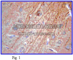 merck millipore,默克密理博,AB2290,Anti-MAP-2 Antibody