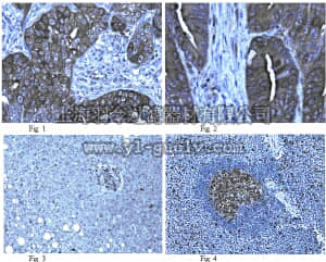 merck millipore,默克密理博,AB2967,Anti-Stathmin Antibody