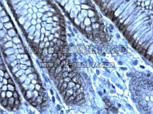 merck millipore,默克密理博,AB2969,Anti-Gelsolin Antibody