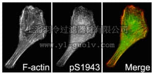merck millipore,默克密理博,AB2974,Anti-phospho-Myosin Heavy Chain 2A (MYH9) (Ser1943) Antibody