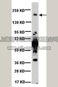merck millipore,默克密理博,AB3560P,Anti-Sodium Antibody, Potassium, Chloride Cotransporter 1
