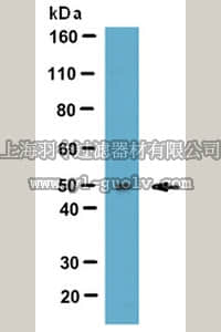 merck millipore,默克密理博,AB4344,Anti-LYAR Antibody (Ly1 Antibody reactive clone)