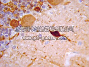 merck millipore,默克密理博,AB5054,Anti-Calretinin Antibody