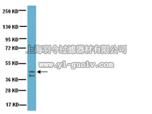 merck millipore,默克密理博,AB5220,Anti-Growth Associated Protein-43 (GAP-43) Antibody