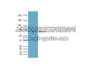 merck millipore,默克密理博,AB5832,Anti-BACE Antibody
