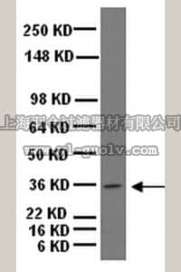 merck millipore,默克密理博,AB5977,Anti-Musashi-1 Antibody