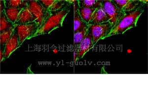 merck millipore,默克密理博,AB5983,Anti-Nkx-3.1 Antibody