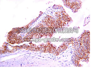 merck millipore,默克密理博,AB6004,Anti-MT1-MMP Antibody, hinge region