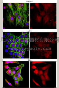 merck millipore,默克密理博,AB6019,Anti-Thymosin beta-4 Antibody