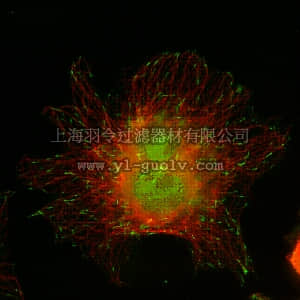 merck millipore,默克密理博,AB6033,Anti-End-binding protein 3 (EB3) Antibody