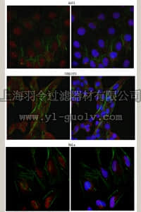 merck millipore,默克密理博,AB6055,Anti-Kinesin-like protein KIF2C Antibody