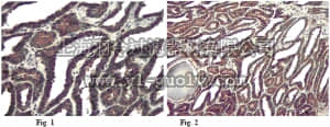 merck millipore,默克密理博,AB6058,Anti-Alpha Centractin (ARP1) Antibody