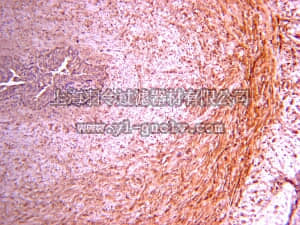 merck millipore,默克密理博,AB764P,Anti-Procollagen Type III PIIINP Antibody