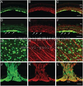 merck millipore,默克密理博,AB9568,Anti-Neurofilament L Antibody