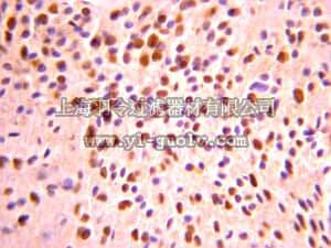 merck millipore,默克密理博,AB9610,Anti-Olig-2 Antibody
