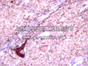 merck millipore,默克密理博,AB9668,Anti-Tau phospho Threonine 231 Antibody