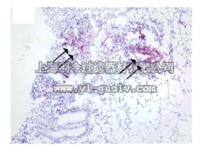merck millipore,默克密理博,AB9728,Anti-S100A12 Antibody