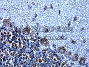 merck millipore,默克密理博,AB9864R,Anti-NMDAR1 Antibody, clone 1.17.2.6, rabbit monoclonal