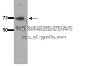 merck millipore,默克密理博,AB9920,Anti-Heat Shock Protein 70 (HSP 70) Antibody