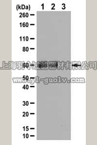 merck millipore,默克密理博,ABC105,Anti-Phospho-Src (Tyr419) Antibody