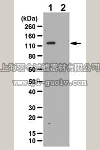 merck millipore,默克密理博,ABC112,Anti-phospho-ULK1/ATG1 (Ser758) Antibody