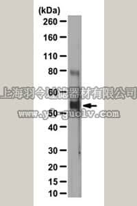 merck millipore,默克密理博,ABC118,Anti-phospho Beclin Antibody (Thr119)