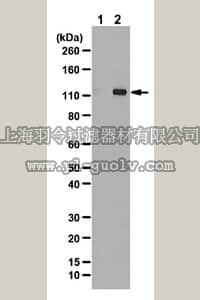 merck millipore,默克密理博,ABC124,Anti-phospho-ULK1 (Ser555) Antibody