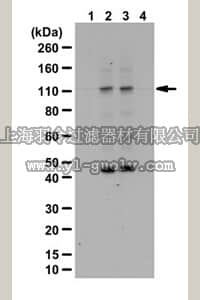 merck millipore,默克密理博,ABC212,Anti-phospho ULK1 Antibody (Thr574)
