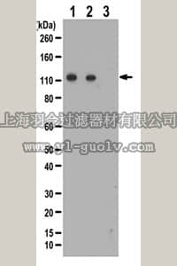 merck millipore,默克密理博,ABC213,Anti-phospho ULK1 Antibody (Ser777)