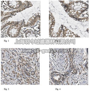 merck millipore,默克密理博,ABC223,Anti-WISP-1 Antibody