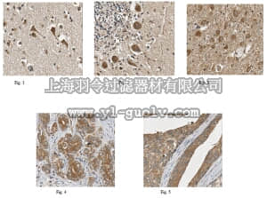 merck millipore,默克密理博,ABC245,Anti-REDD1 Antibody merck millipore,默克密理博,ABC245,Anti-REDD1 Antibody