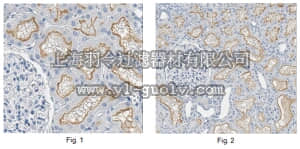 merck millipore,默克密理博,ABC246,Anti-Angiotensin-converting enzyme Antibody