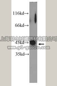 merck millipore,默克密理博,ABC262,Anti-LGALS9 Antibody