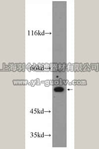 merck millipore,默克密理博,ABC278,Anti-CYP24A1 Antibody