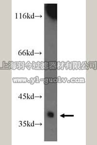 merck millipore,默克密理博,ABC286,Anti-CTSL2 Antibody