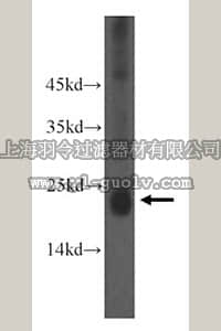 merck millipore,默克密理博,ABC289,Anti-NPC2 Antibody