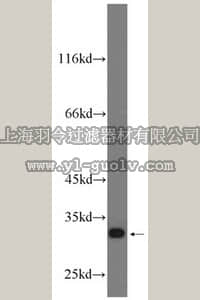 merck millipore,默克密理博,ABC292,Anti-CHMP2B Antibody