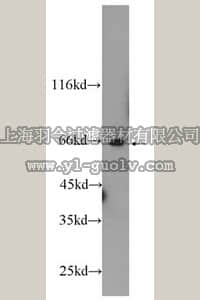 merck millipore,默克密理博,ABC293,Anti-PRCC Antibody