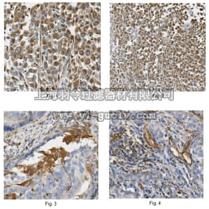merck millipore,默克密理博,ABC307,Anti-CIP2A Antibody