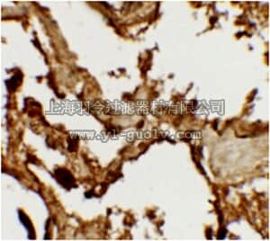 merck millipore,默克密理博,ABC325,Anti-VKORC1 Antibody