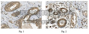 merck millipore,默克密理博,ABC330,Anti-ACVR1 Antibody